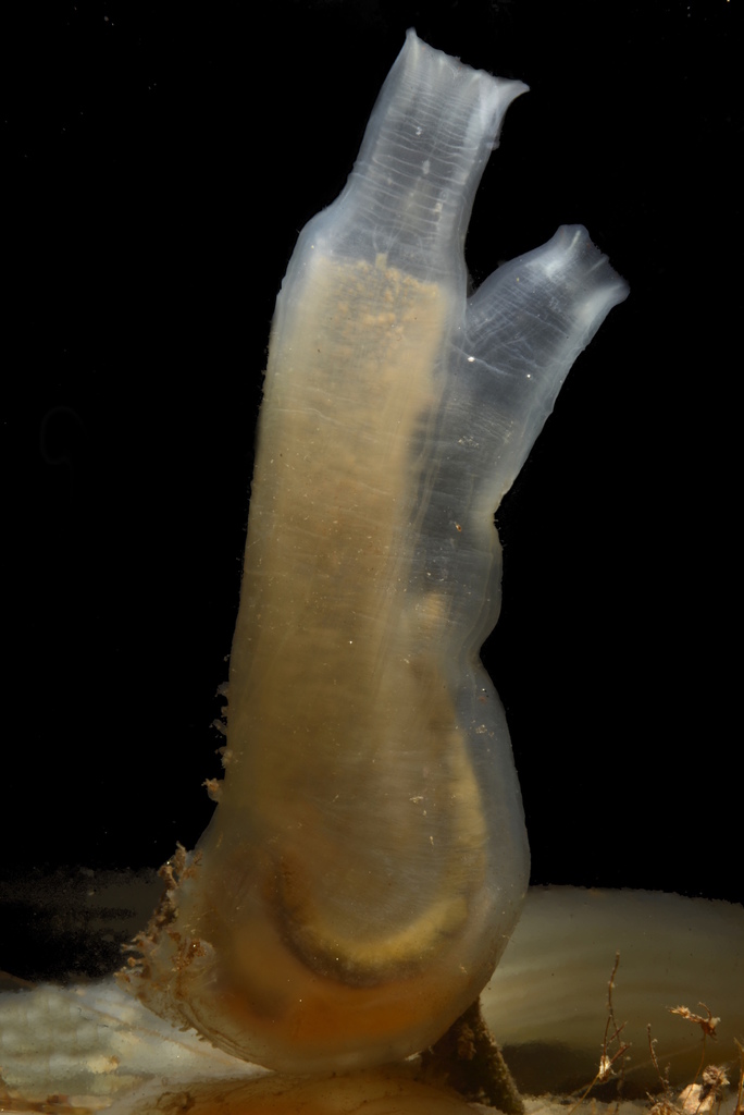 Cione intestinale